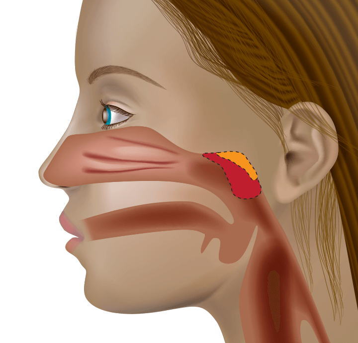 adenoidectomy-selcuk-inanli1