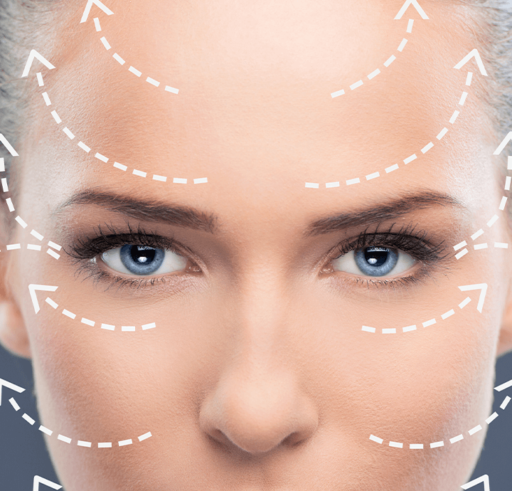 forehead-stretching-selcuk-inanli1