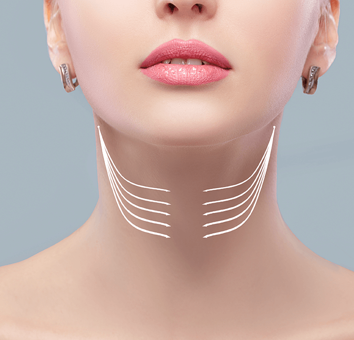 neck-lift-selcuk-inanli1