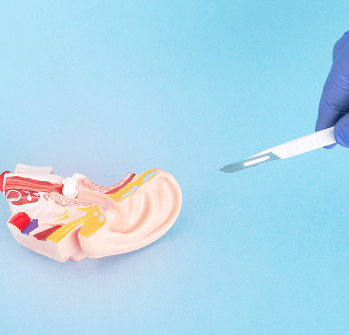 tympanoplasty-selcuk-inanli1