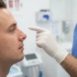 Septoplasti