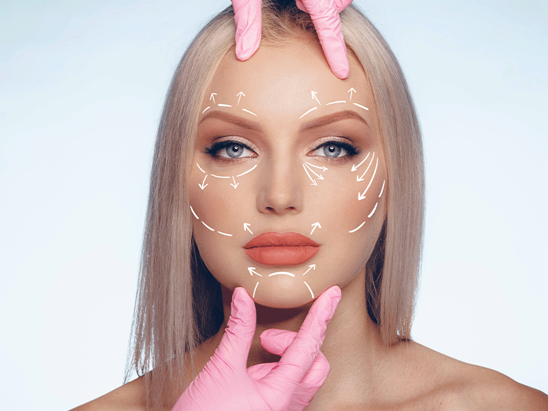 facelift1